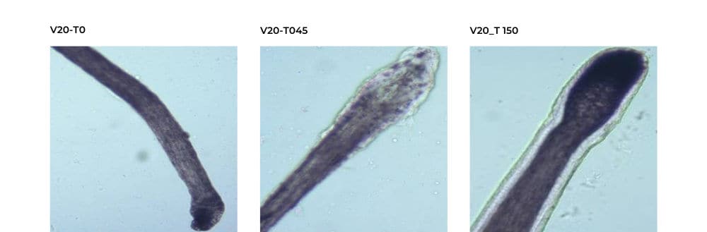 Prevenhair: Evolución