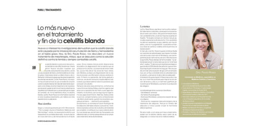 Lo más nuevo en el tratamiento y fin de la celulitis blanda